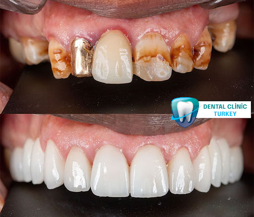 Dental Clinic Istanbul Turkey,Dental Clinics Turkey — 4