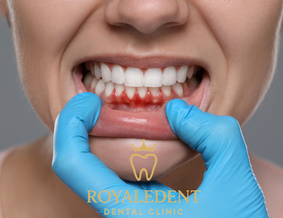 ROYALE DENT