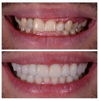 Periodontoloji ve İmplant Uzmanı Uzm. Dr. Sümeyra Köse Bursa diş eti hastalıkları uzmanı
