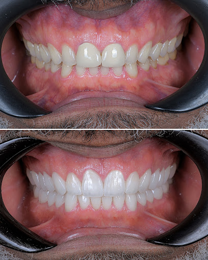 Uzm. Dr. Arten Dyrmishi Dental Clinic - Çene Cerrahisi Uzmanı & Estetik Diş Hekimliği