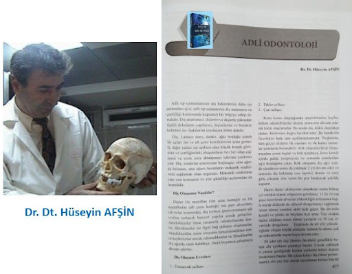 Dr. Dt. HÜSEYİN AFŞİN — 4