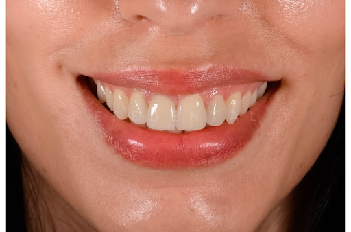 Efe Dental Klinik - Ağız ve Diş Sağlığı Polikliniği,Efe Dental Klinik — 2