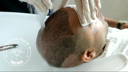 Universal Hair Transplant - Best Hair Transplant in Turkey — 3