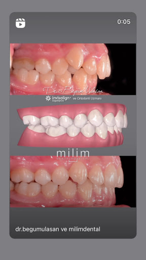 Ortodonti Uzmanı Dr. Begüm Ulaşan — 2