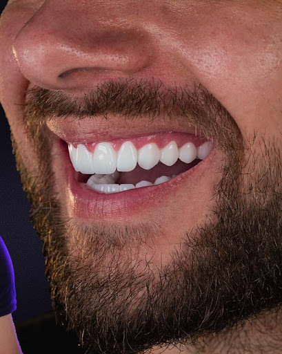 Lavi Clinic Istanbul | Hair Transplant, Dental Implants & Cosmetic Surgeries
