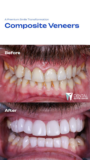 Dental Estetik Center — 4