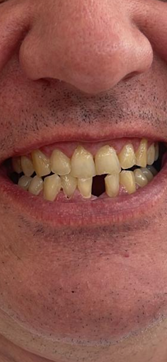 Özel Atlas Dental Ağız ve Diş Sağlığı Polikliniği — 4