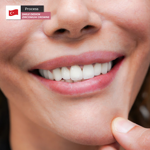 Dental and Medical Center | Dentist | Free And Immediate Online Diagnosis | Istanbul — 4