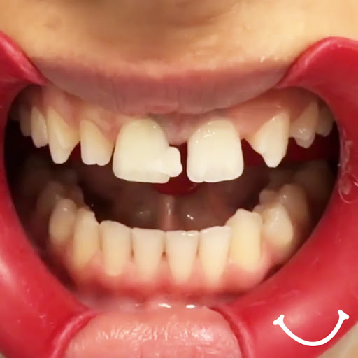 Inovadent Ortodonti Ataşehir Ağız ve Diş Sağlığı Polikliniği,İnovadent Orthodontics — 3
