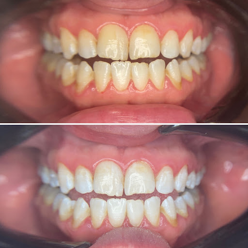 Diş Hekimi Tuğçe ÖZKAN - Elmalı Dent Diş Polikliniği — 2