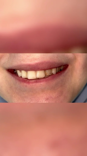 عيادة الدكتور محمد عبدالسلام لزراعة وتجميل الأسنان - اسطنبول — 3