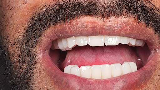 عيادة الدكتور محمد عبدالسلام لزراعة وتجميل الأسنان - اسطنبول — 4