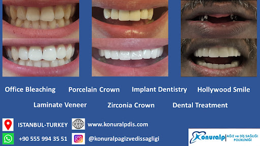 Özel Konuralp Ağız Ve Diş Sağlığı Polikliniği,Special Konuralp Oral and Maxillofacial Clinic