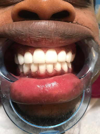 Dental Turkey instagram / Dental Clinic İstanbul / عيادة اسنان في اسطنبول / Zahnklinik in Istanbul