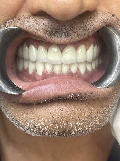 Diş Bahçesi Ağız ve Diş Sağlığı Polikliniği - İstanbul Kartal Diş Klinikleri — 2