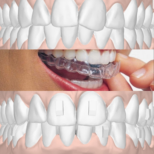 Ortodonti Kliniği Dr. Ibrahim Burak Aydin