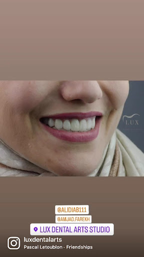 LUX Dental arts studio مركز لوكس لطب الاسنان — 3
