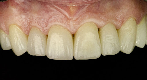 LUX Dental arts studio مركز لوكس لطب الاسنان — 4