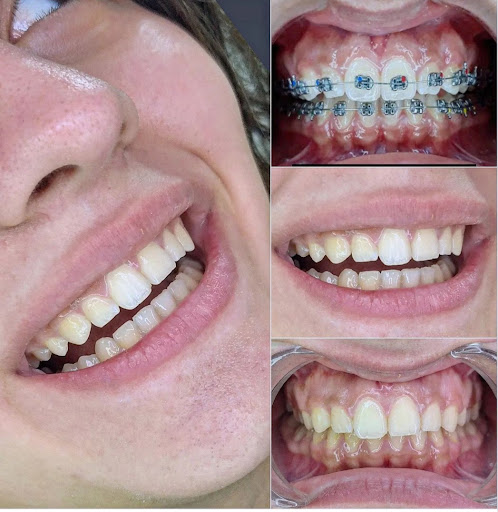 34 Dental Smile — 4