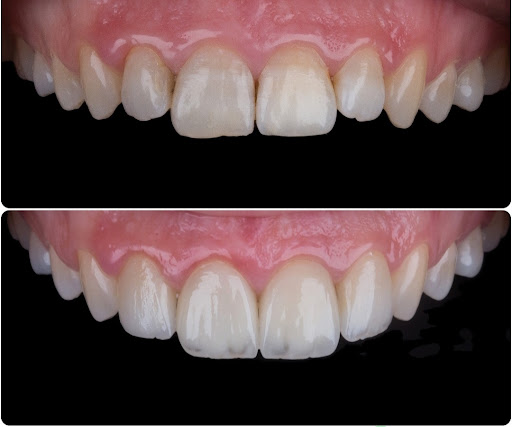 34 Dental Smile