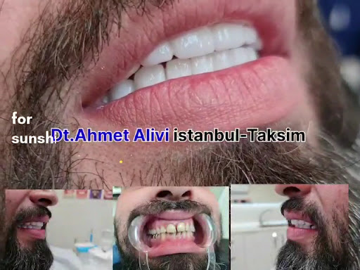 Dentist AHMET ALİVİ/Dental Clinic/طبيب أسنان عربي — 4
