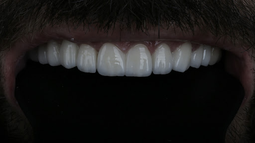 Taksim Dental Clinic — 2