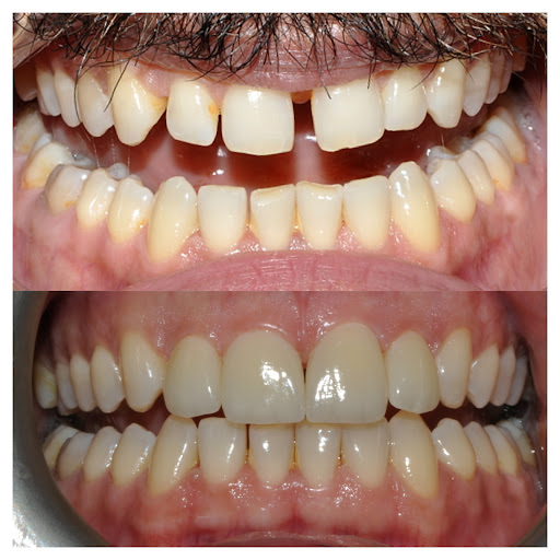 Taksim Dental Clinic — 3