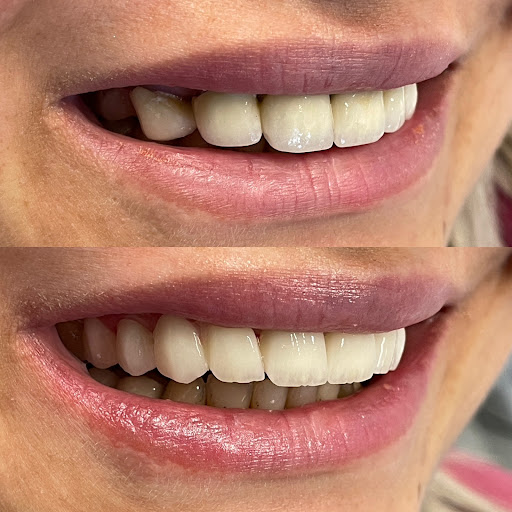Dr.Bilgenur ŞAHİN PERİODONTOLOJİ KLİNİK — 4