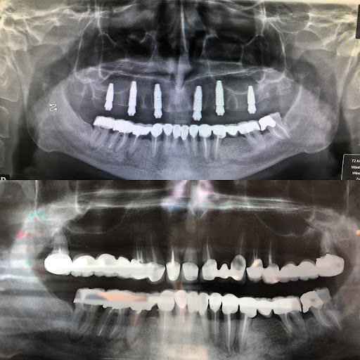 Best Dentist in Turkey İstanbul - Dr. Samet - Dental Implants Turkey - Best Dental Clinic in Turkey — 4