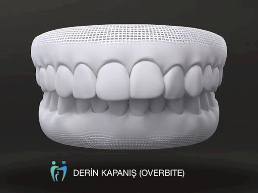 Eskişehir Ortodonti Dr. Dt. Banu Erbaş — 3