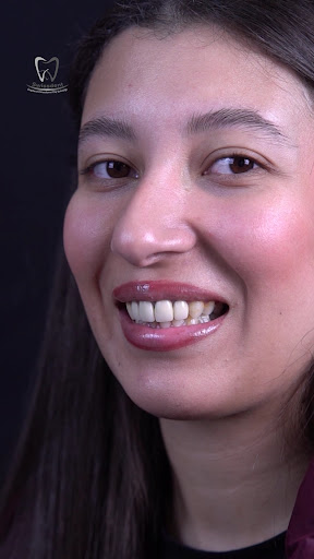 Swissdent Ankara dentist د. علاء شعيبات طبيب اسنان انقرة digtorka ilkaha — 3