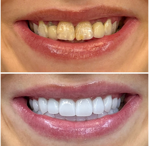 Swissdent Ankara dentist د. علاء شعيبات طبيب اسنان انقرة digtorka ilkaha — 4