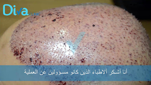 Diva clinic Istanbul medical tourism agency — 3