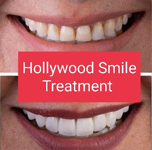 DR MERT AKBAŞ DİŞ KLİNİĞİ-1 ÇENE CERRAHİSİ ZİGOMATİK İMPLANT - MAXILLOFACIAL SURGERY - Dentist - Zahnarzt- стоматолог — 4