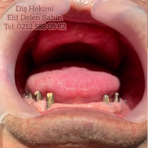 Diş Hekimi Elif Delen Şahin — 3
