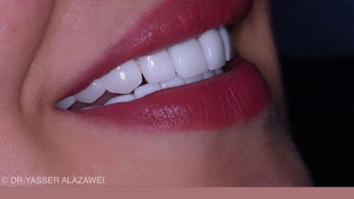 HD Dental Ağız ve Diş Sağlığı Polikliniği | Kadıköy, Bostancı — 2