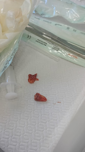 YAVUZ OZCAN DENTAL IMPLANT AND AESTHETIC CLINIC — 3