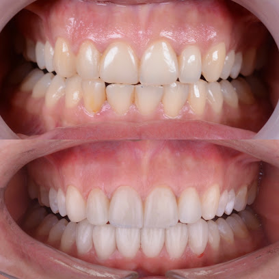 Diş Hekimi Rabia Gökçe | Raa Smile Design Academy