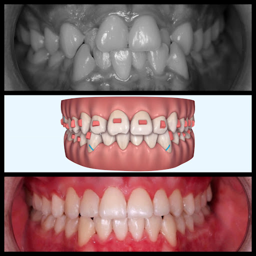 Smile İzmir — 4