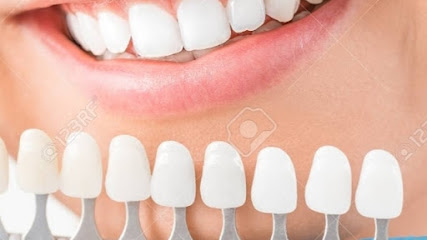 Beyaz Diş Evi Dental Klinik