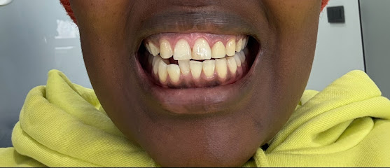 The best dental clinic in turkey | dental implants in turkey | All on 6 | All on 4 | Zirconium crowns | ALL ON X clinic
