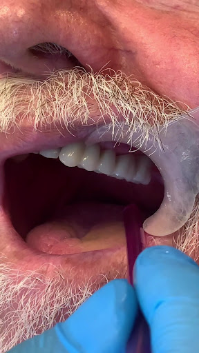 Doç Dr Murat Metin Ağız Diş Çene Cerrahisi Ve İmplant Kliniği — 4
