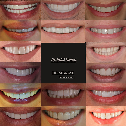 Dentart Diş Kliniği,Dentart Diş Kliniği- Koşuyolu-Diş Estetiği-Dental Clinic-Implant & Esthetic Dentistry — 4