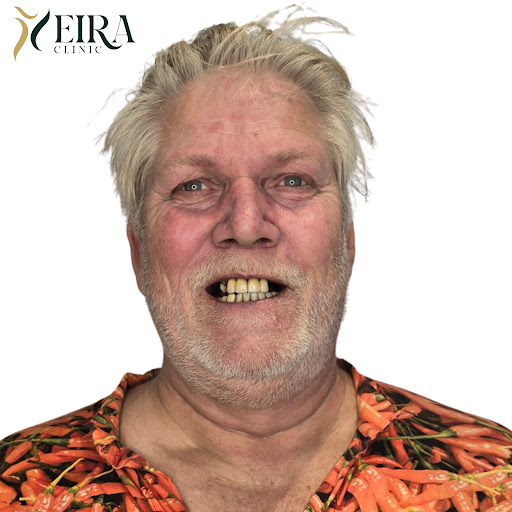 Eira Clinic Istanbul – Dental Implants & Tandimplantater | Hollywood Smile — 4